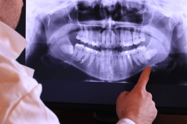 Best Emergency Dental Care for Trauma or Injury in Weston, NJ